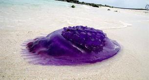Cosa fare in caso di puntura di medusa?